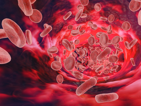 Types of hemophilia and their triggers explained