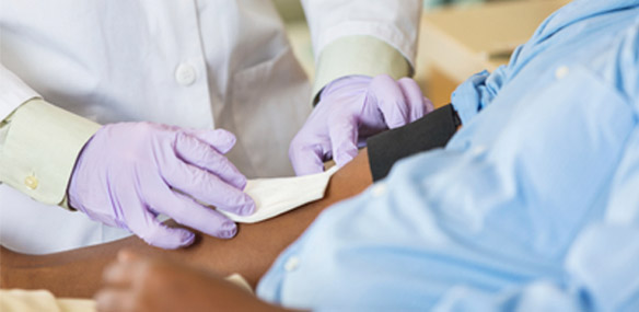 Hep C_Signs and Symptoms of Hep C