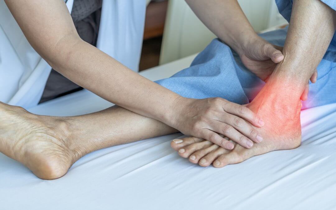 7 Traditional and Alternate Gout Treatments